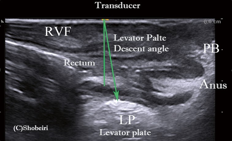 This image for Image Layouts addon